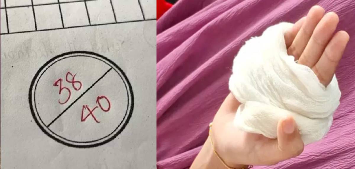 ട്യൂഷൻ ക്ലാസിലെ പരീക്ഷയിൽ രണ്ട് മാർക്ക് കുറഞ്ഞു; വിദ്യാർത്ഥിക്ക് അധ്യാപകന്‍റെ ക്രൂരമർദനം