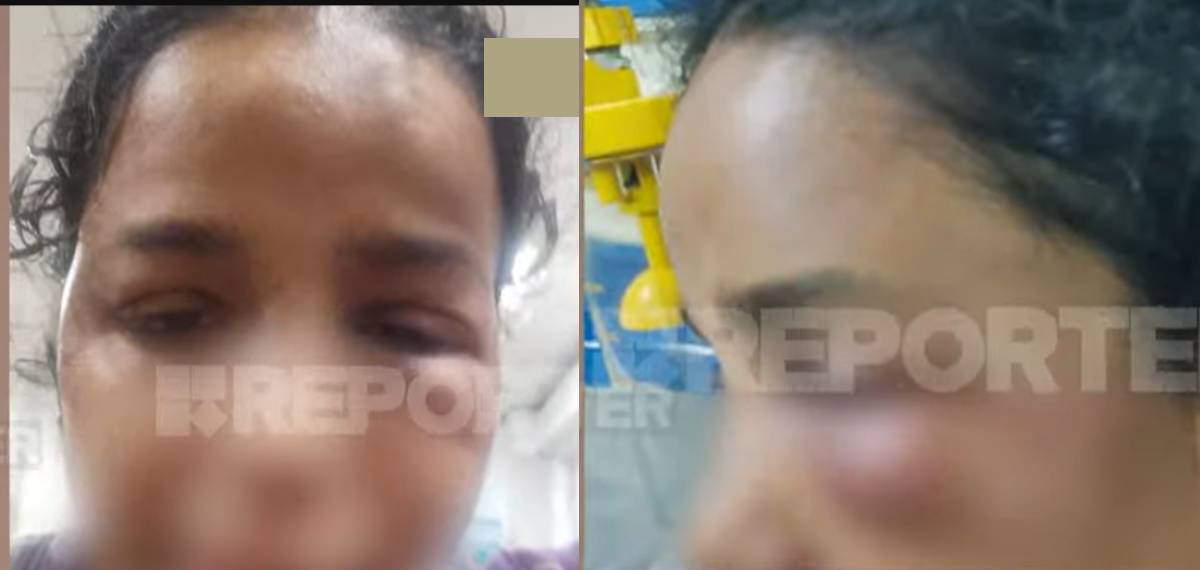 ഒഴിഞ്ഞുപോകണമെന്ന് ആവശ്യപ്പെട്ട് മർദ്ദനം, തല ചുമരിലിടിപ്പിച്ചും ക്രൂരത; കോട്ടയത്ത് ഭർത്താവിനെതിരെ പരാതി