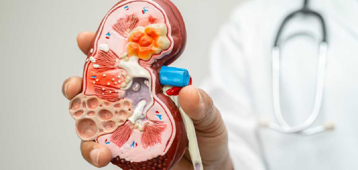 വൃക്കയെ തകരാറിലാക്കുന്ന ശീലങ്ങള്‍ എന്തൊക്കെ? ആദ്യ ലക്ഷണങ്ങള്‍ അറിയാതെ പോകുന്നത് എന്തുകൊണ്ട്?