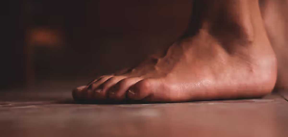 hair loss on toes a sign of diabetes