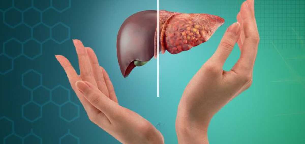 ശ്രദ്ധിക്കണേ...; ഫാറ്റി ലിവര് ഉള്ളവര് ഈ മൂന്ന് പാനിയങ്ങള് കുടിക്കരുത്