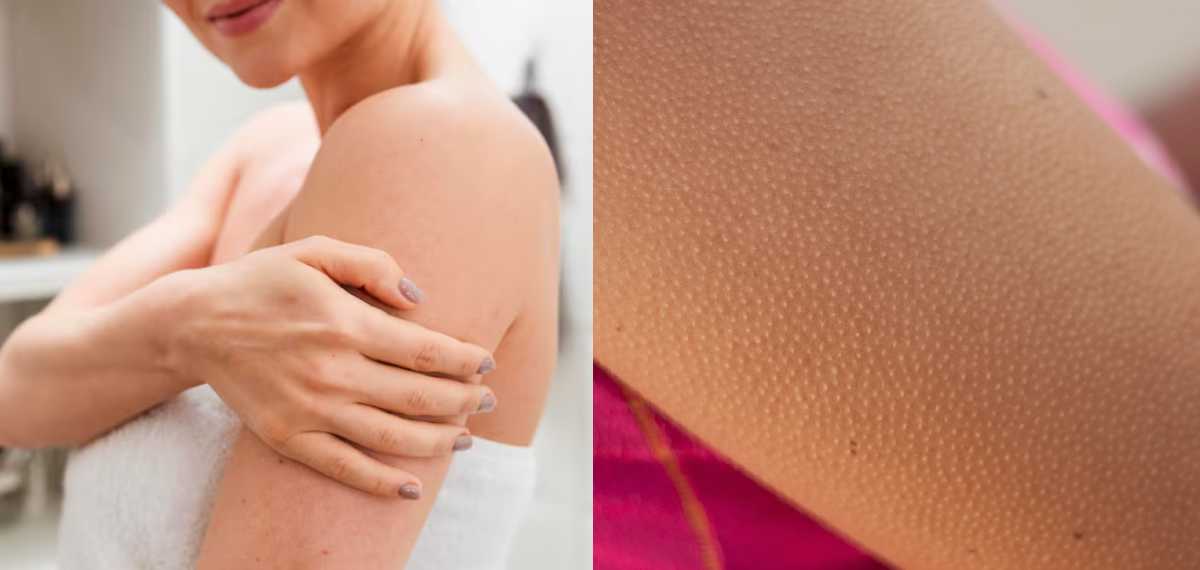 രോമാഞ്ചത്തിന് പിന്നിലെ രഹസ്യം എന്താണെന്നറിയണോ?