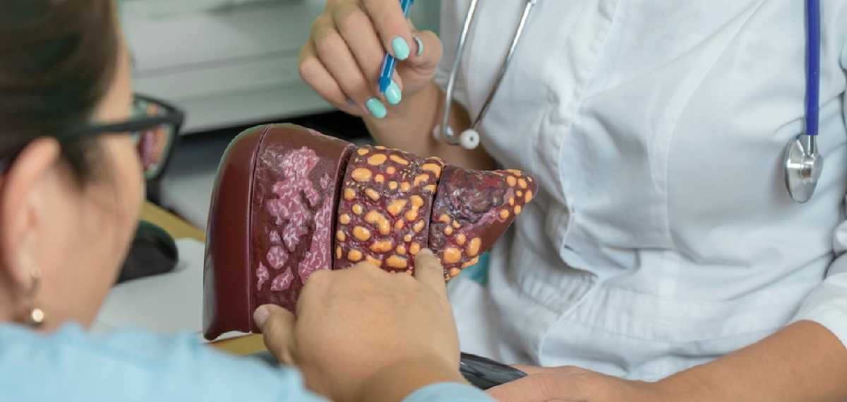 ലിവര്‍ സിറോസിസിന്റെ അവസാന ഘട്ട ലക്ഷണങ്ങള്‍; ശരീരം നല്‍കുന്ന ചില സൂചനകള്‍ അവഗണിക്കരുത്