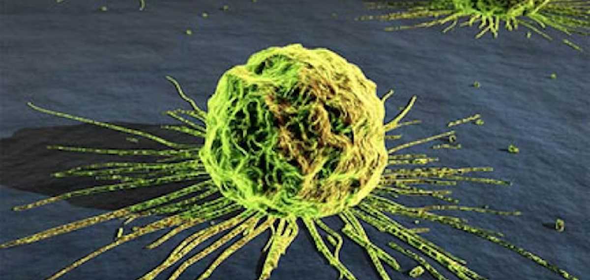 daily habits can cause cancer