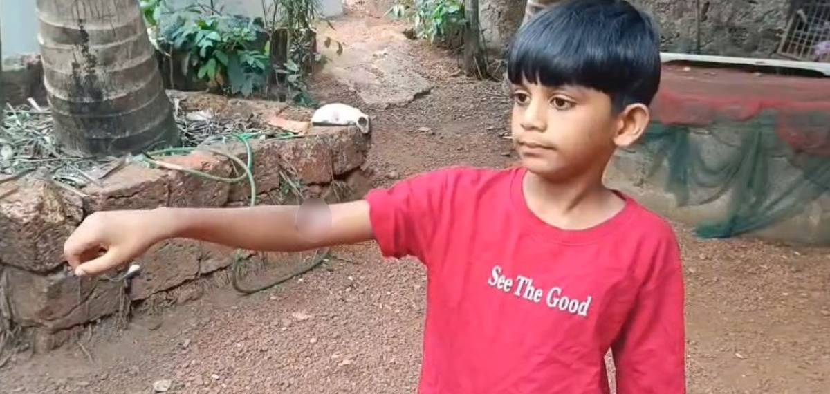 മലപ്പുറത്ത് രണ്ടാം ക്ലാസുകാരന് സൂര്യാതപമേറ്റു