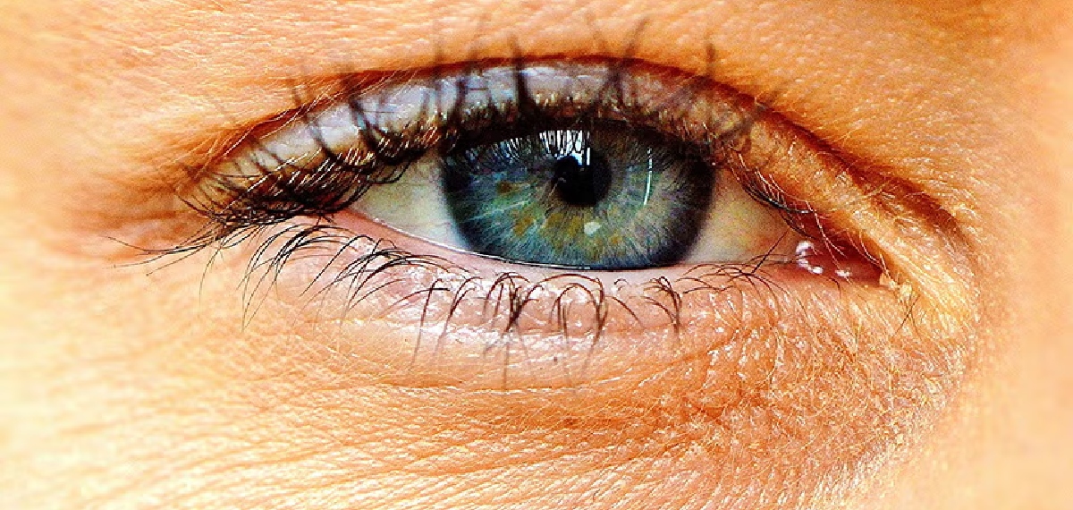 puffy eyes and kidney