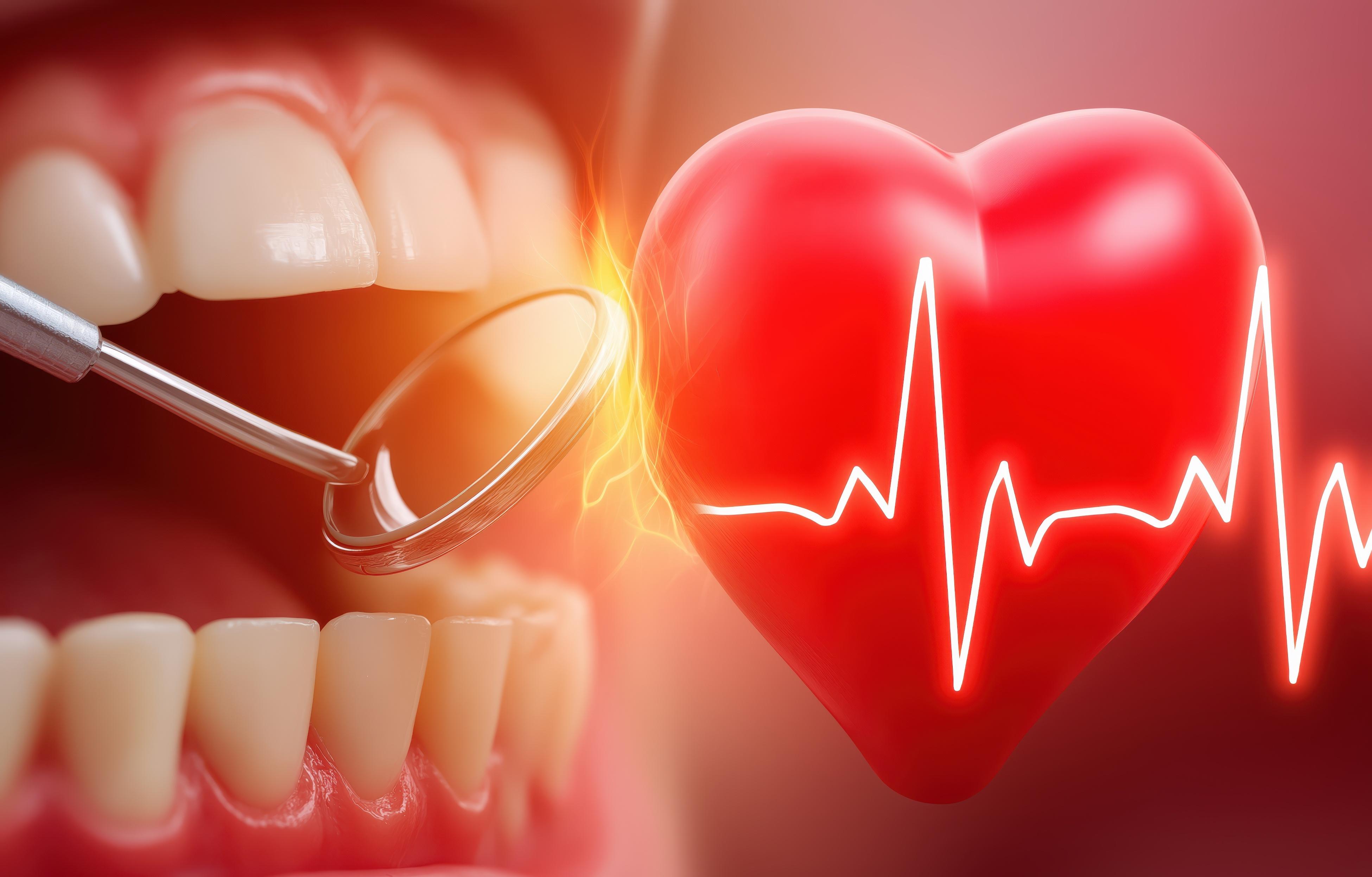 ORAL HEALTH AND HEART ATTACK