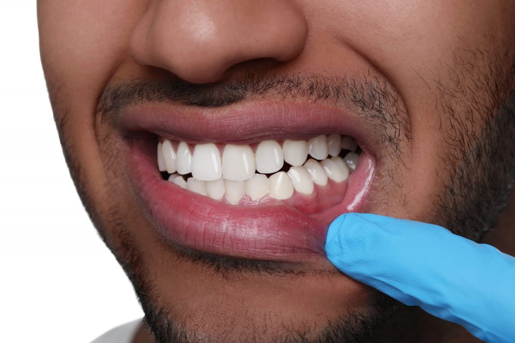 ORAL HEALTH AND HEART ATTACK