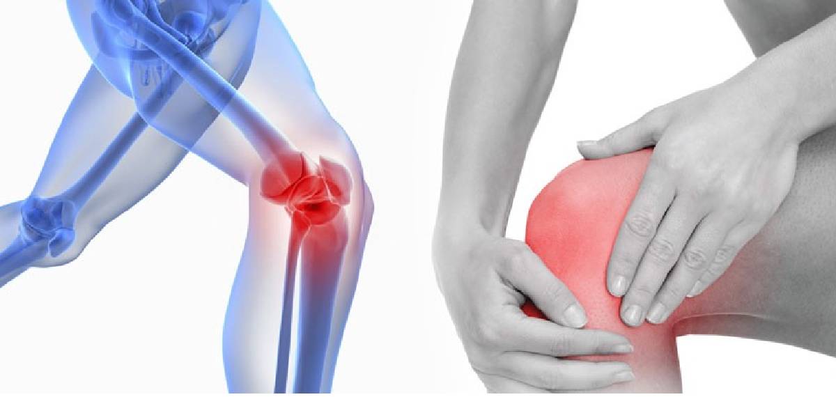 knee pain in 30's