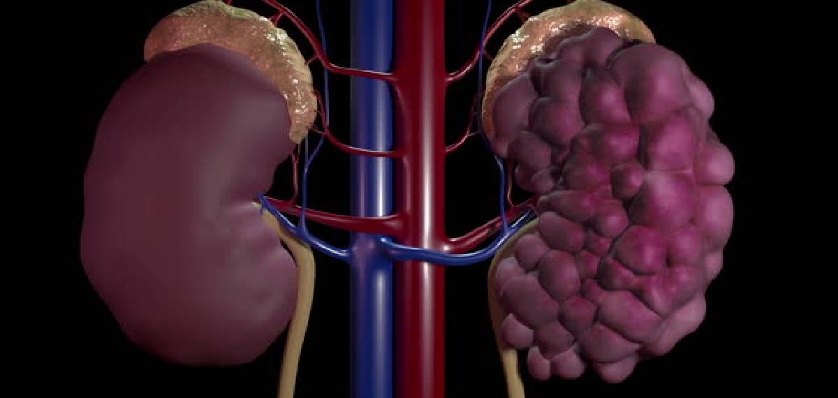kidney health after 40