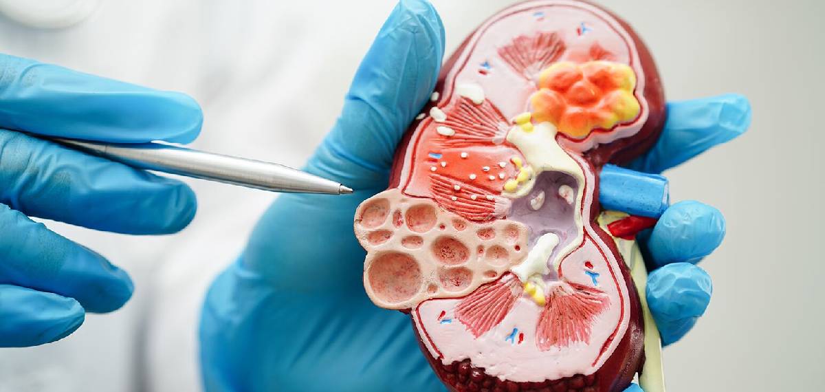 kidney health after 40