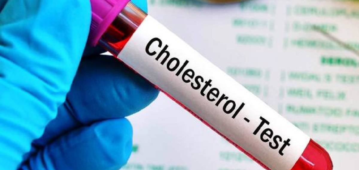 cholesterol symptoms