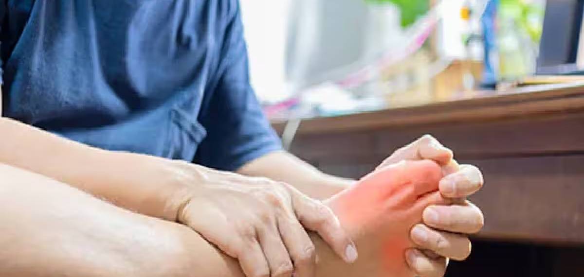 uric acid symptoms 