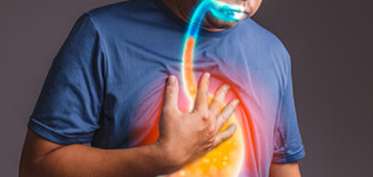 ACID REFLEX