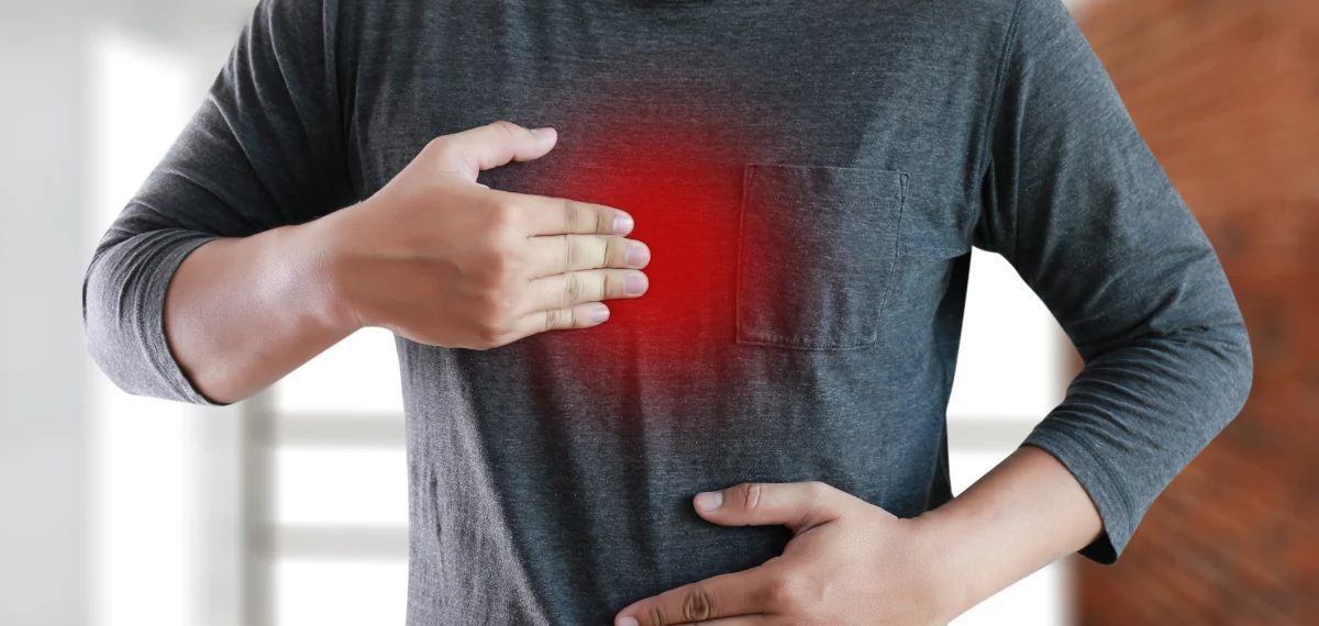 ACID REFLEX