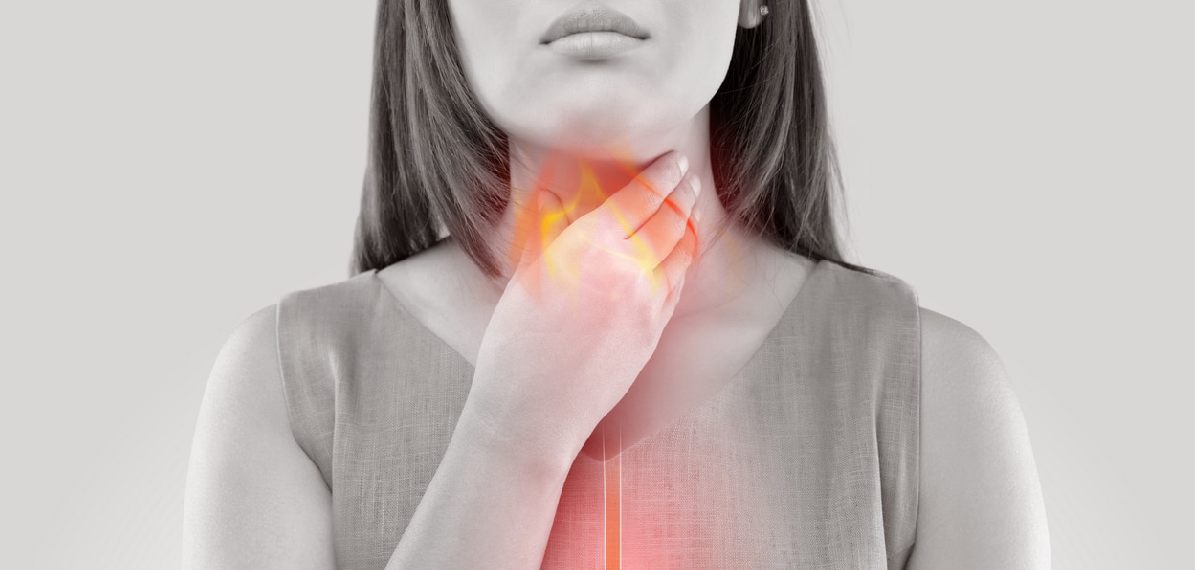 ACID REFLEX
