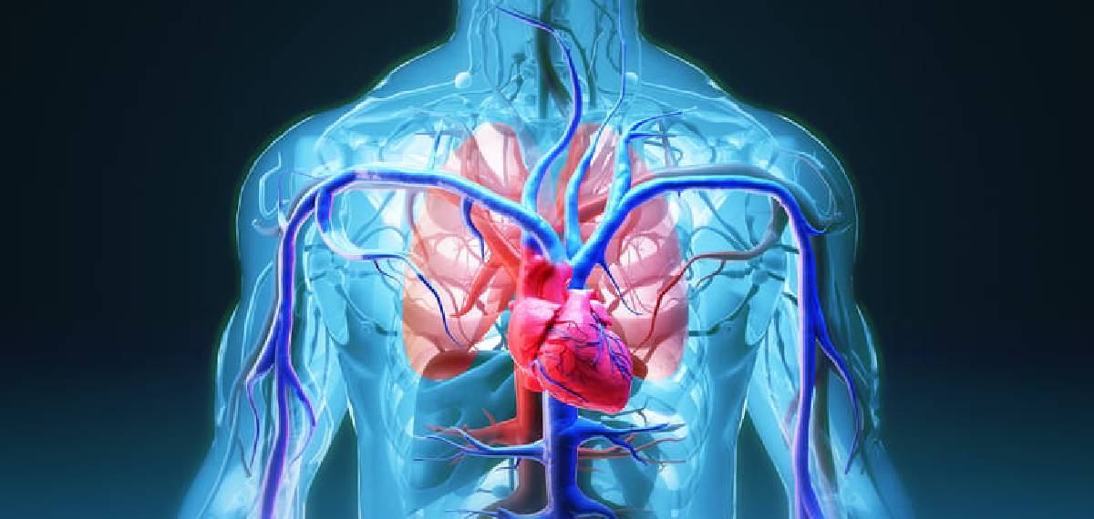 coronary artery disease