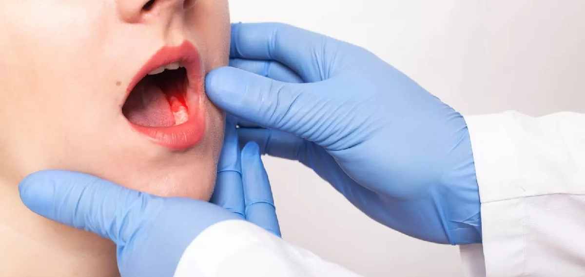 warning signs of oral cancer