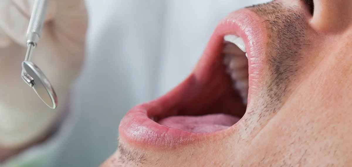 warning signs of oral cancer