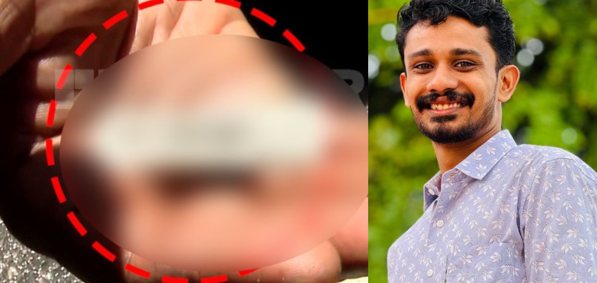 'ഏത് SFIക്കാരന്റെ കൈയിലാണ് ബ്ലേഡ് എന്ന് കാണിച്ച് തരണം';ബാരിക്കേഡ് അഴിക്കുന്ന ദൃശ്യങ്ങൾ പങ്കുവച്ച് M ശിവപ്രസാദ്