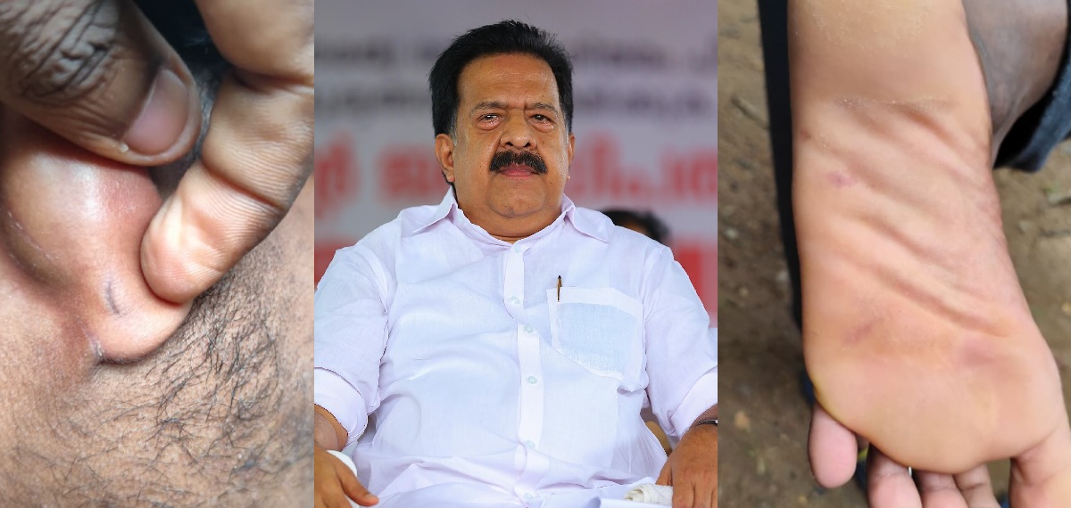 സഹപാഠികൾ പീഡിപ്പിച്ചെന്ന 13കാരിയുടെ വ്യാജ പരാതി: പൊലീസിനെതിരെ 20കാരൻ ആഭ്യന്തരമന്ത്രിക്ക് പരാതി നൽകി