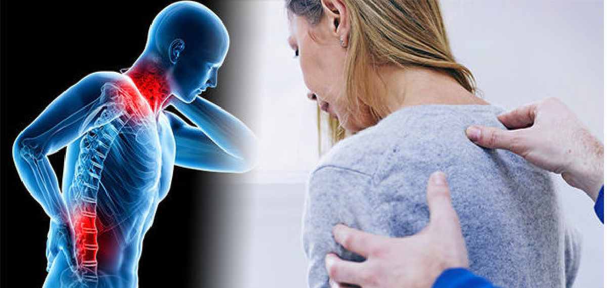 fibromyalgia