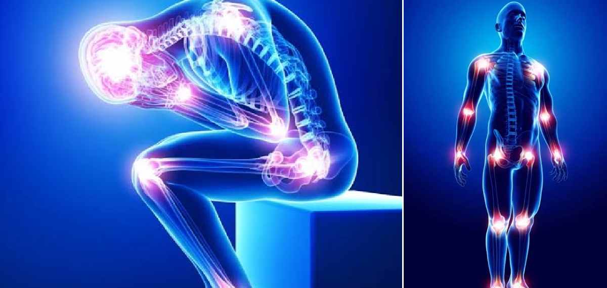 fibromyalgia