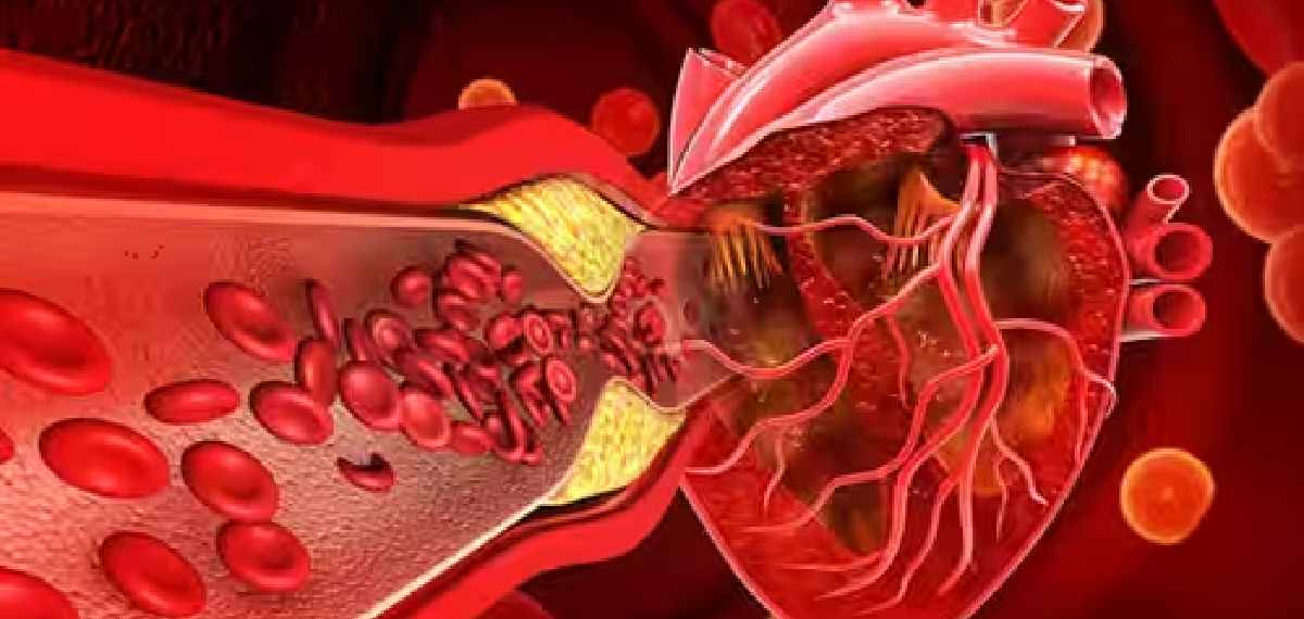 cholesterol and blood pressure