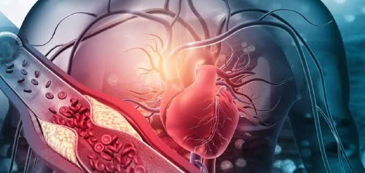 ശ്രദ്ധിക്കുക; കൊളസ്ട്രോളിന്റെയും രക്തസമ്മര്ദ്ദത്തിന്റെയും ലക്ഷണങ്ങള് എങ്ങനെ തിരിച്ചറിയാം