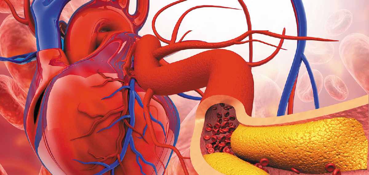 cholesterol and blood pressure