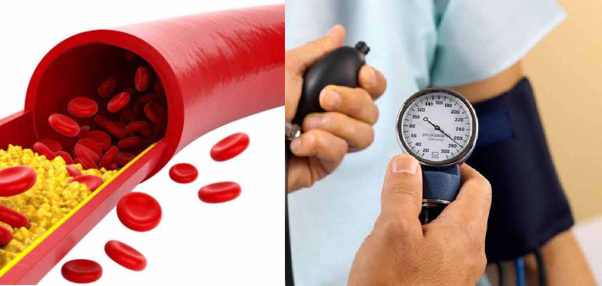 cholesterol and blood pressure