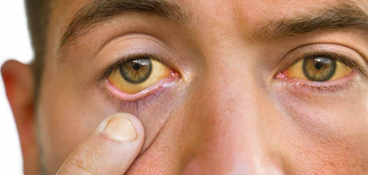 symptoms of liver damage
