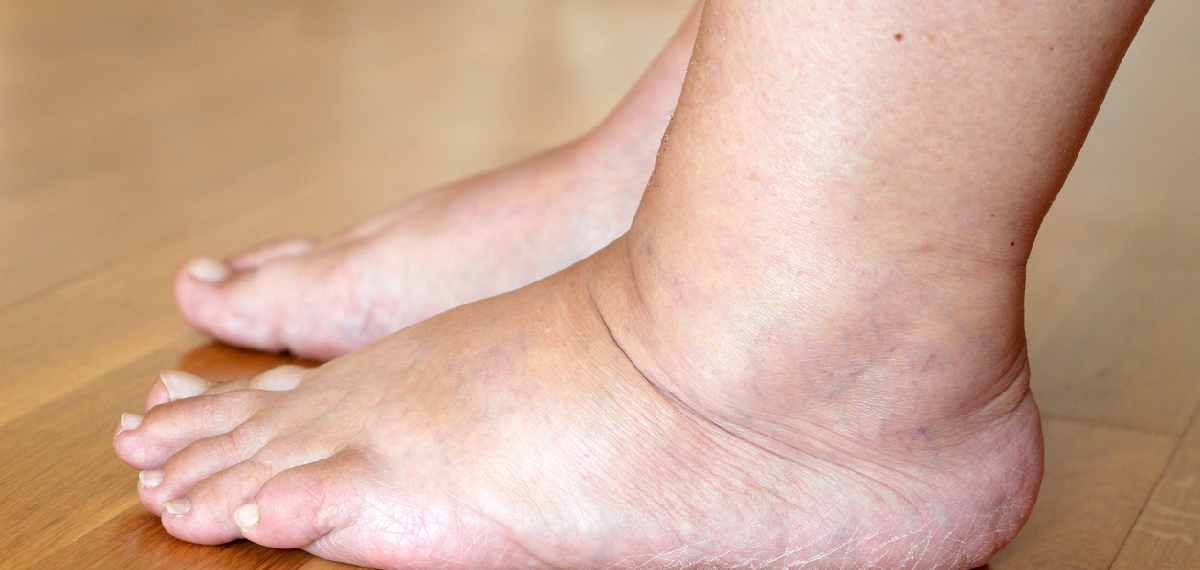 symptoms of liver damage