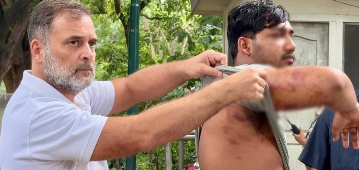 ഡല്‍ഹി പ്രക്ഷോഭം; സമരക്കാര്‍ക്ക് നേരെ 7 തവണ പെല്ലറ്റ് ഗണ്‍ ഉപയോഗിച്ചെന്ന് കണ്ടെത്തല്‍, സഭയില്‍ ഉയര്‍ന്നേക്കും