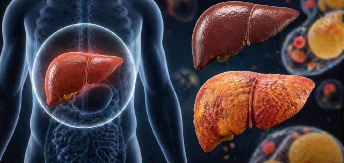  risk of developing hepatitis