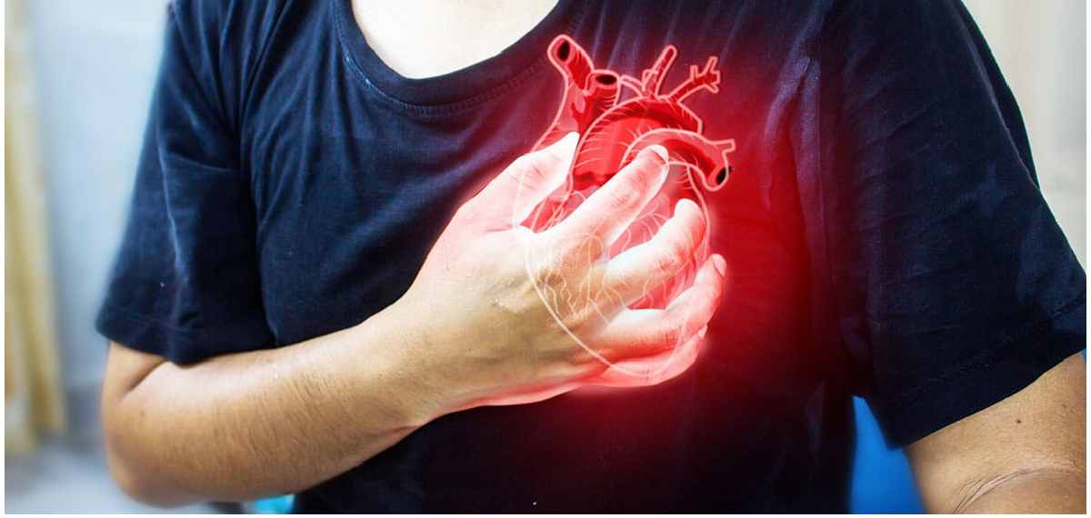 heart attack and cardiac arrest