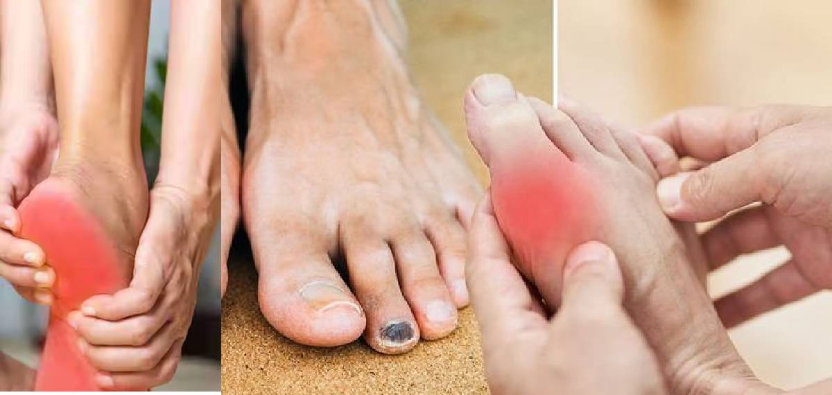 signs the body gives when cholesterol