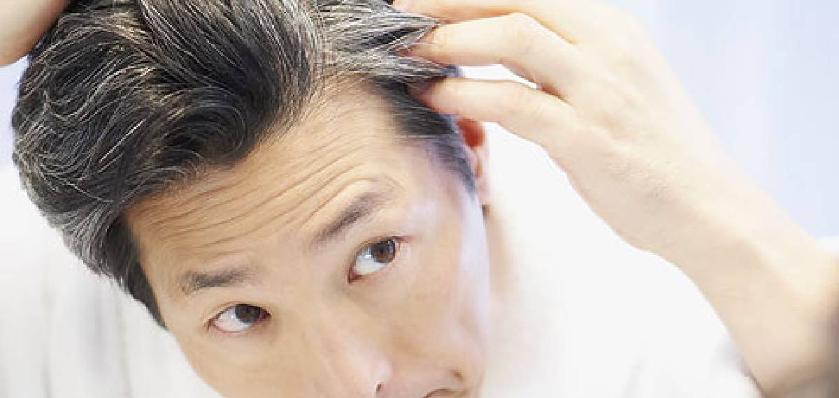 hair turning grey before the age of 35