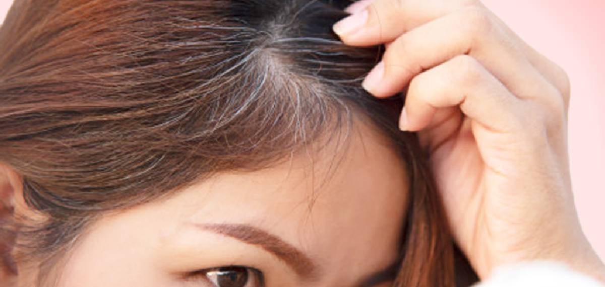 hair turning grey before the age of 35