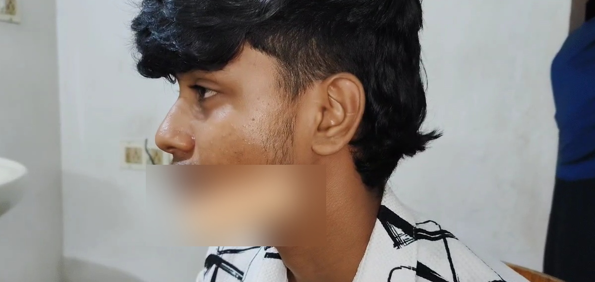 തിരുവനന്തപുരത്ത് പ്ലസ് ടു വിദ്യാര്‍ത്ഥിക്ക് നേരെ ആക്രമണം; പ്രതി പിടിയില്‍