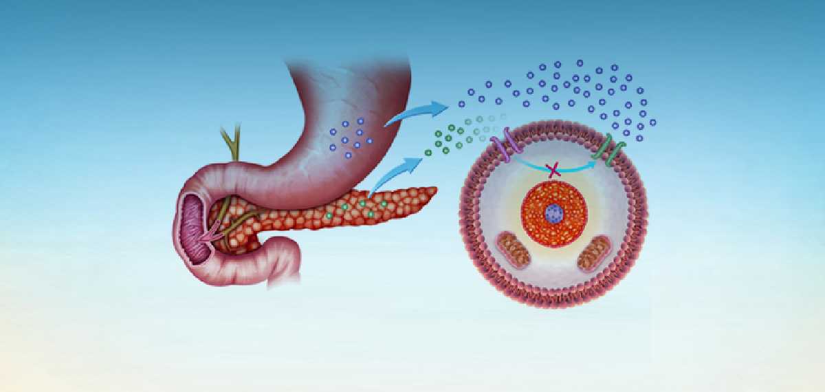 diabetic ketoacidosis