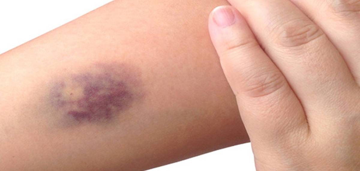 liver failure symptoms