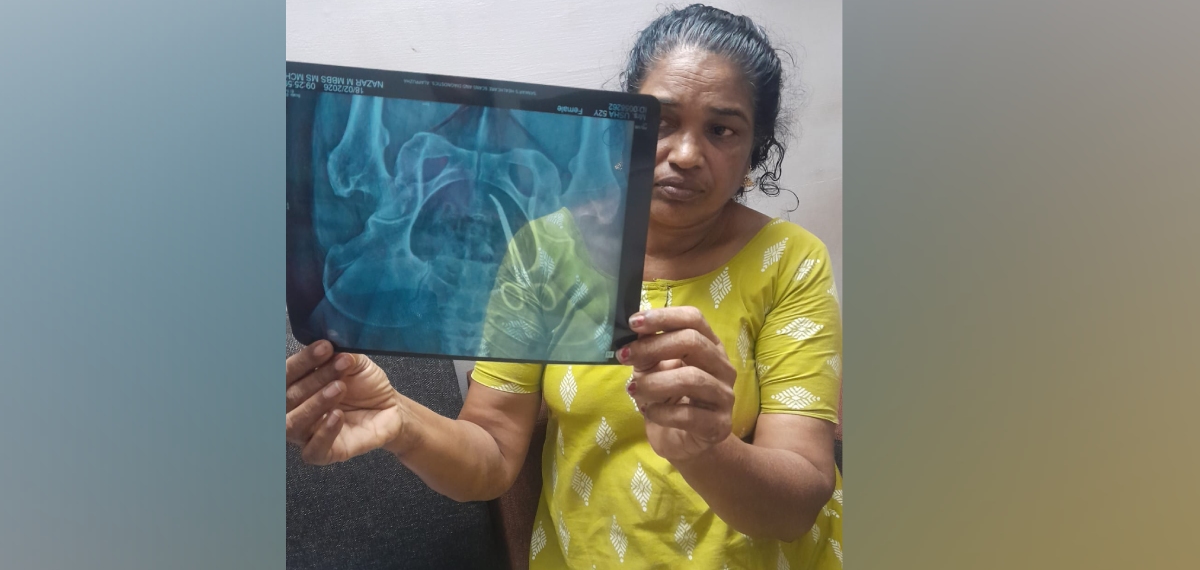 ആലപ്പുഴയിൽ വീട്ടമ്മയുടെ വയറ്റിൽ 5 വർഷമായി കത്രിക; മെഡിക്കൽ കോളേജിലെ ശസ്ത്രക്രിയക്കിടെ മറന്നുവെച്ചതെന്ന് പരാതി