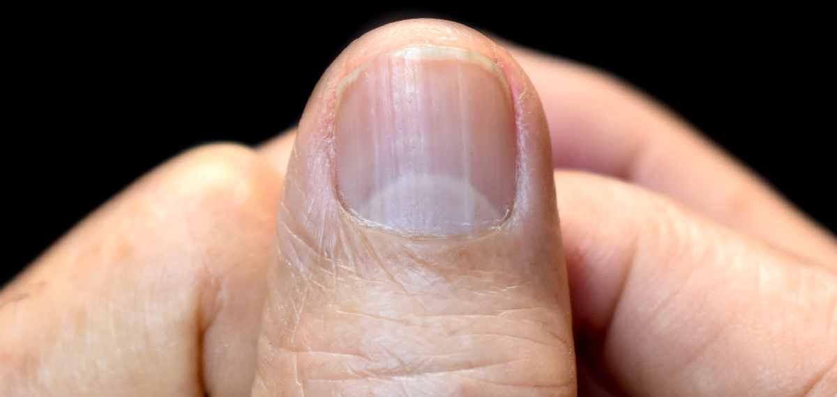 Lunula on Nails