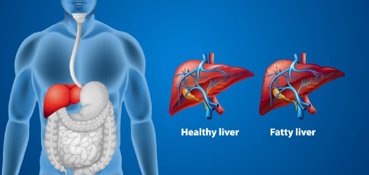 liver health