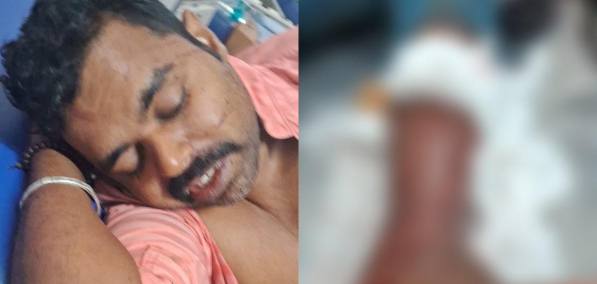 നെയ്യാറിൽ കാട്ടാന ആക്രമണം; വനം വകുപ്പ് താത്കാലിക ജീവനക്കാരന് പരിക്ക്