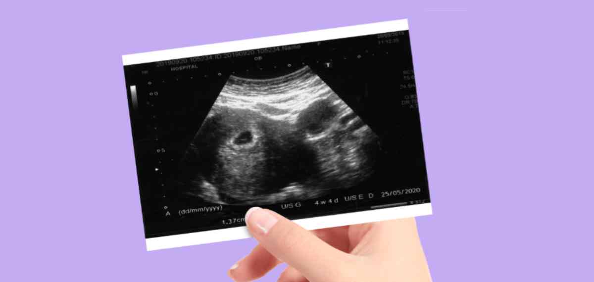 Pregnancy related new study is out