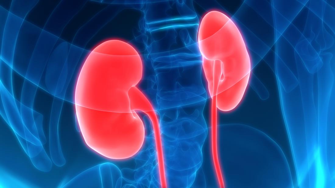 kidney attack