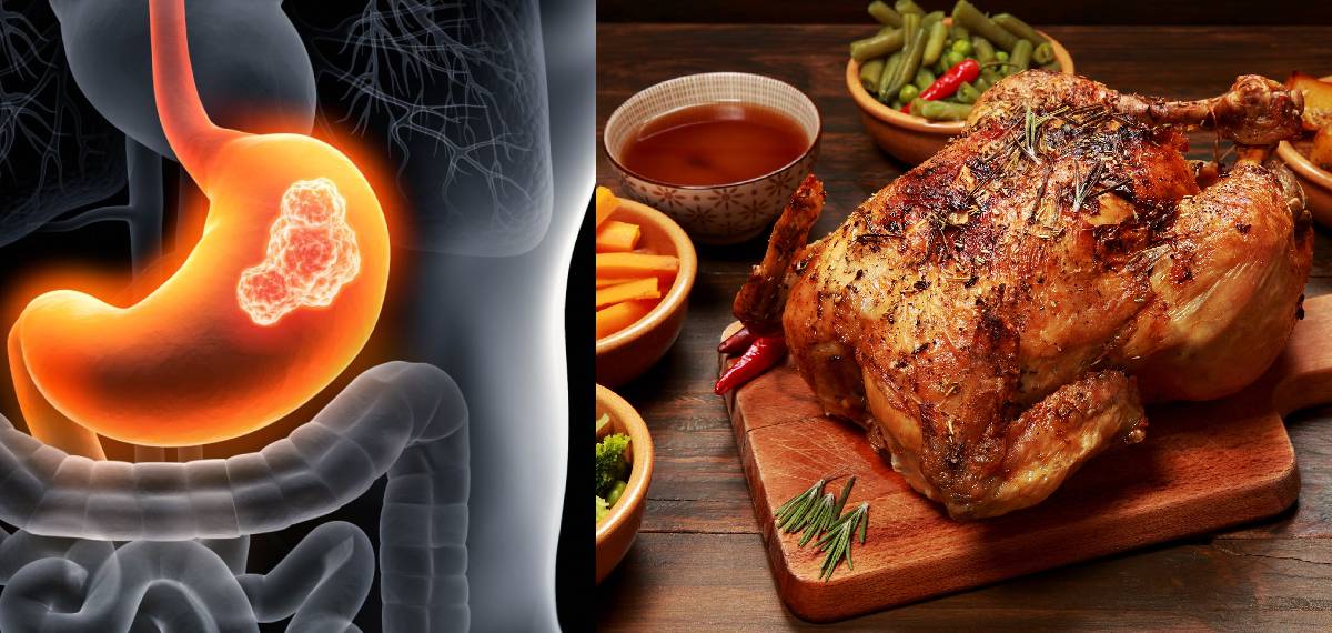 ചിക്കന് കഴിക്കുന്നവരാണോ? ഗ്യാസ്ട്രിക് കാന്സറിനുള്ള സാധ്യത വര്ധിപ്പിച്ചേക്കാമെന്ന് പഠനം