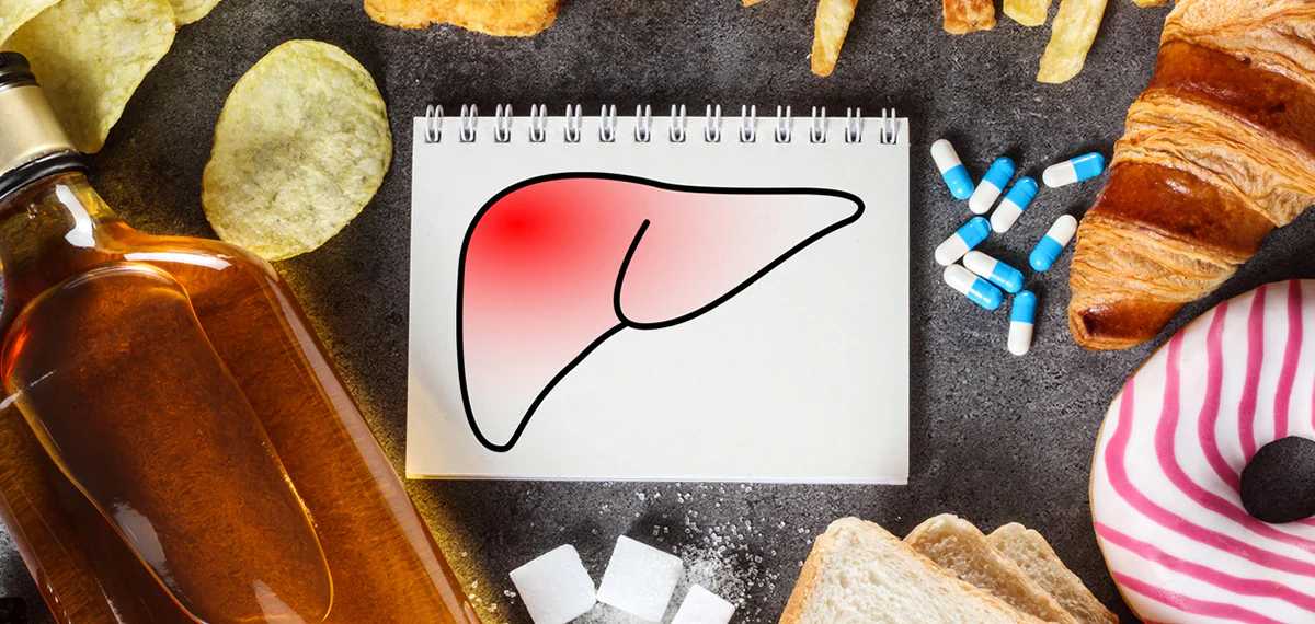 non fatty liver 